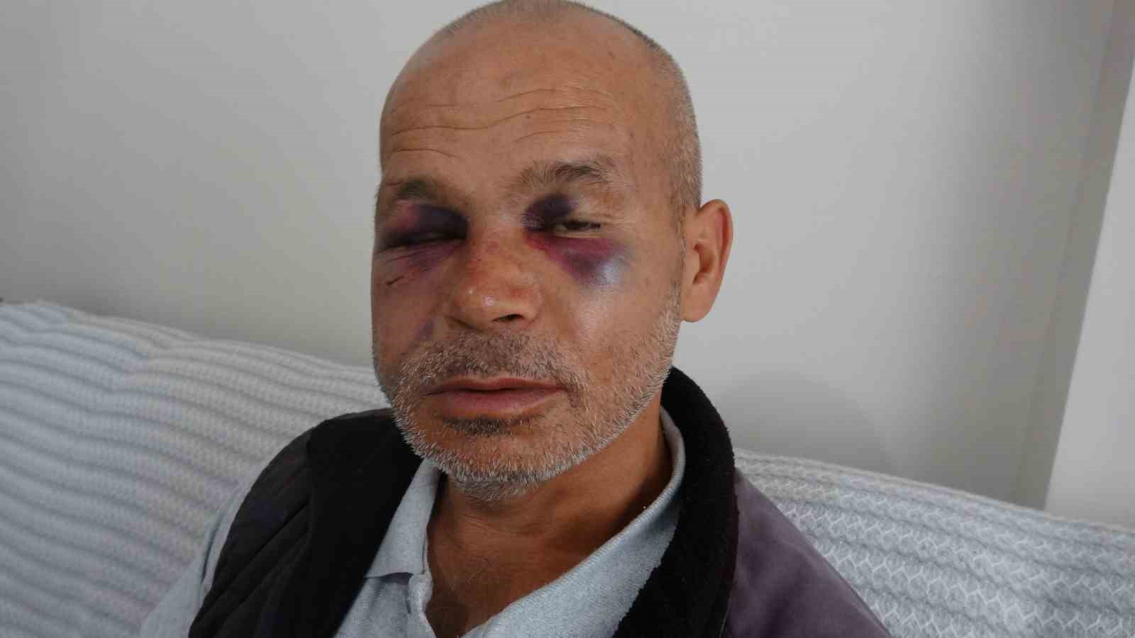 MUHAMMED SONBAŞ KİMLİĞİ BELİRSİZ KİŞİLER TARAFINDAN DARP EDİLDİ